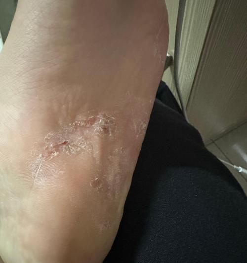 探讨丁丁功放的音质表现及性能评价（揭秘丁丁功放的音频解码和放大技术，为您选择音响设备提供参考）-第2张图片-星耀数码