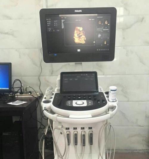 飞利浦E310手机的优点与缺点（一款实用的功能机，值得拥有）-第2张图片-星耀数码